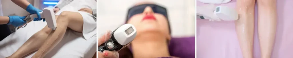 Laseroperationer för att förbättra hudens utseende efter neurologiska sjukdomar