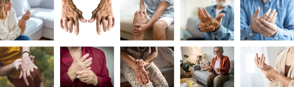 Användning av laser för att förbättra hudens utseende efter degenerativa sjukdomar