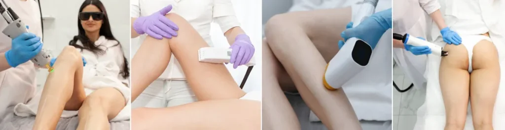 Användning av laser för att förbättra hudens utseende efter medicinska behandlingar