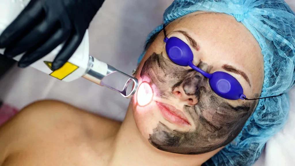 användning av laser för att förbättra hudens utseende efter nanoteknik