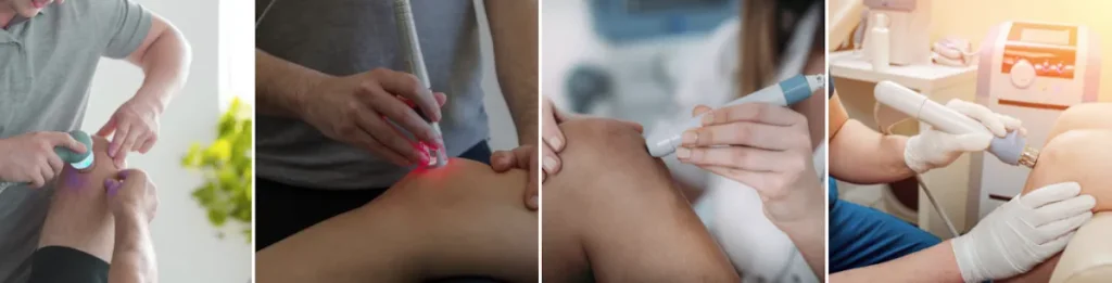 Användning av laser för att förbättra knänas utseende