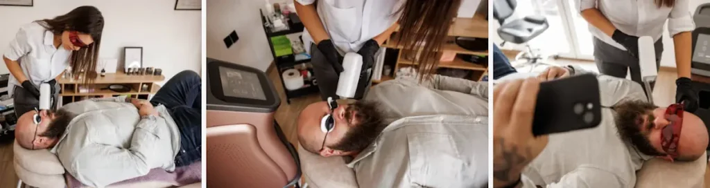 Användning av laser för att ta bort hår i ansiktet