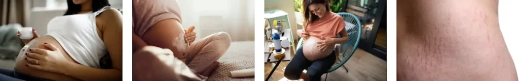 användning av laserbehandling för bristningar