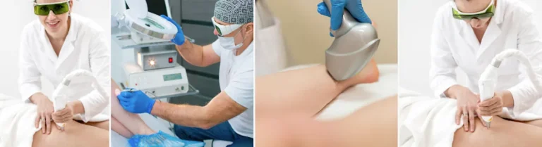 är laserbehandlingar för kärlproblem smärtsamma