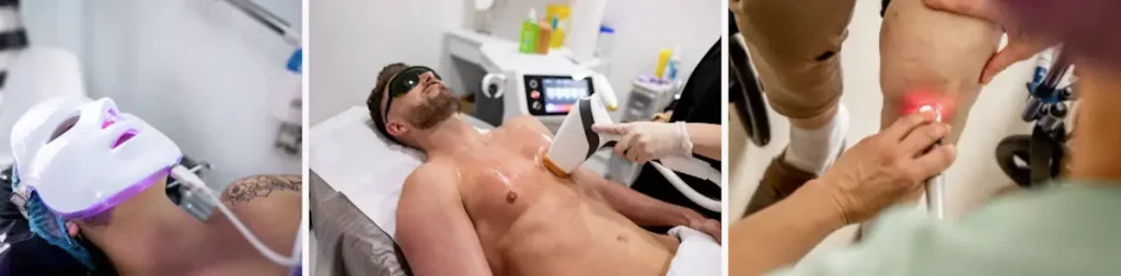 Återhämtningstid efter en laseroperation