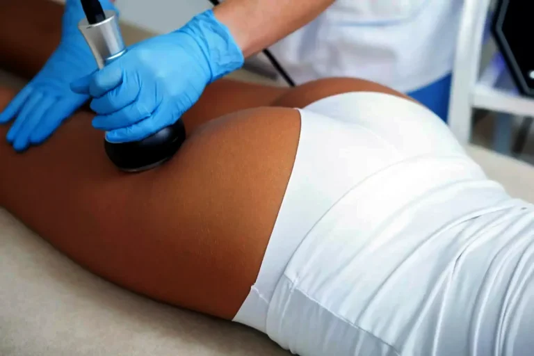 behandlingar för att behandla celluliter med laser
