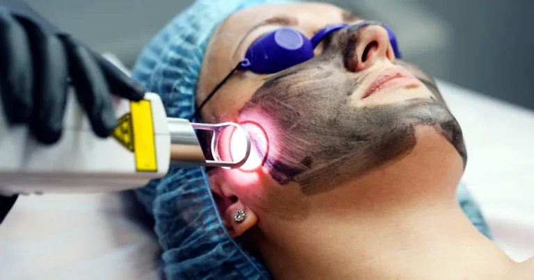 co2 laser