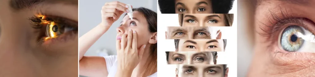 Erosion av hornhinnan efter ögonlaseroperationer