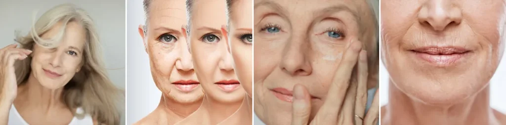 Fördelar med laser för att behandla åldersfläckar