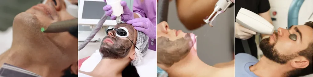 Fördelar med laser för att förbättra hudens utseende efter antivirala behandlingar