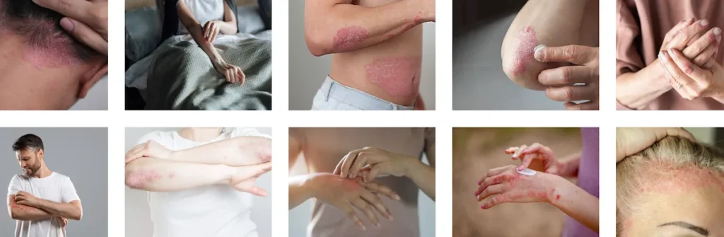 Fördelar med laser för att förbättra hudens utseende efter biologisk behandling