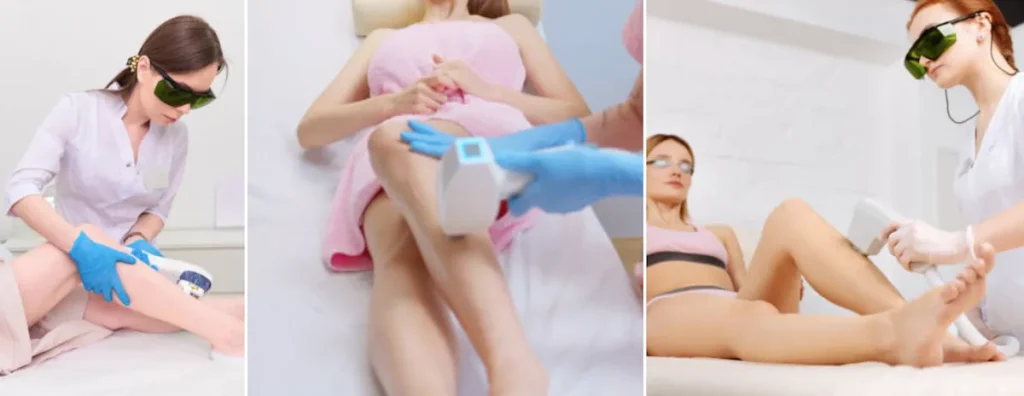 Fördelar med laser för att förbättra hudens utseende efter hormonbehandlingar