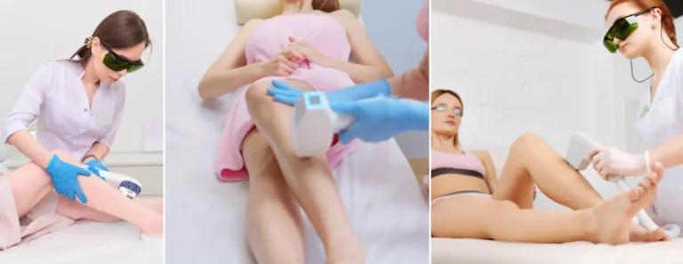Fördelar med laser för att förbättra hudens utseende efter hormonbehandlingar