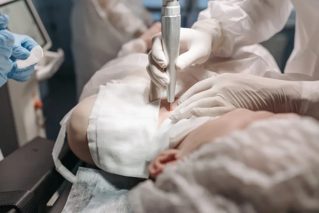 Fördelar med laser för att förbättra hudens utseende efter virusinfektioner