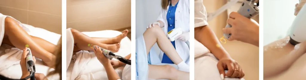 Fördelar med laserhårborttagning jämfört med andra metoder