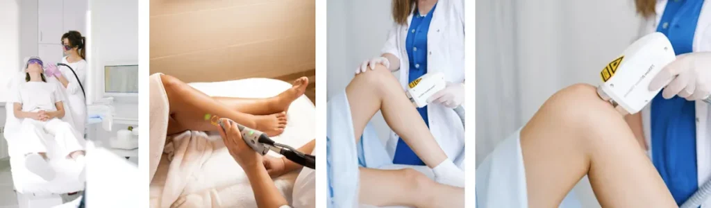 Förlust av naturlig elasticiteti huden efter laserbehandling