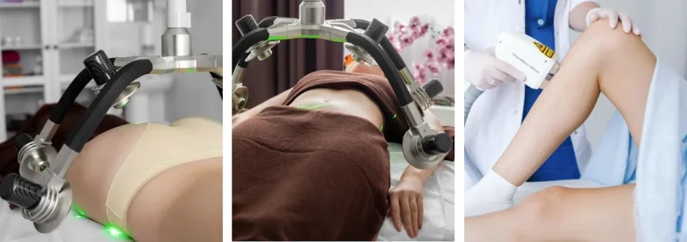 gör det ont att genomgå en laseroperation