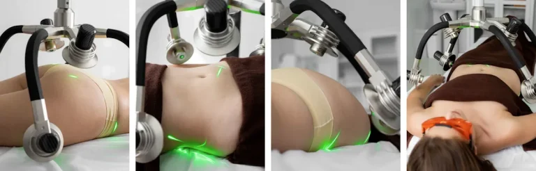 hur skiljer sig laserfettsugning från traditionell fettsugning