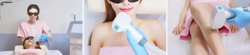 Intense Pulsed Light