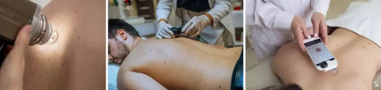 kan laserbehandlingar kombineras med andra behandlingar för hudcancer