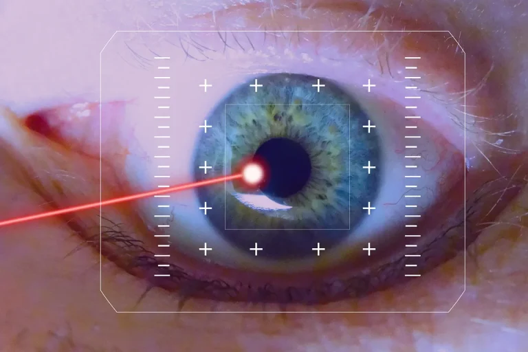 Laser-Assisted in Situ Keratomileusis