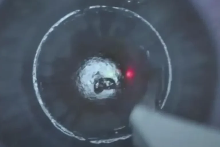 laser-assisted sub-epithelial keratectomy