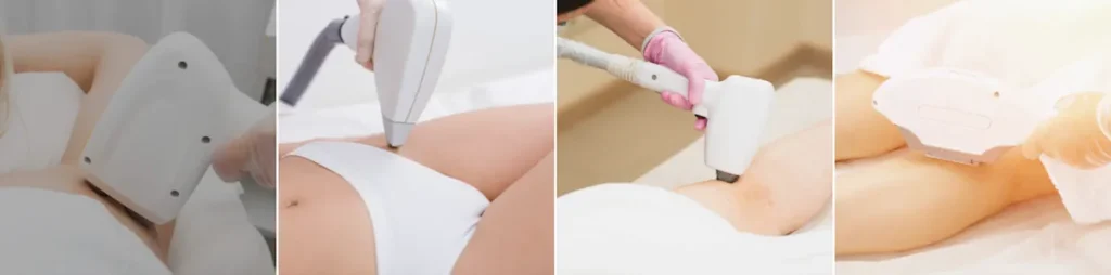 laserbehandling för ben och armar