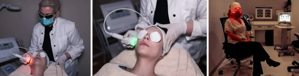 Laserbehandling för förbättrad hudstruktur