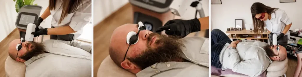 laserbehandling för hårväxt