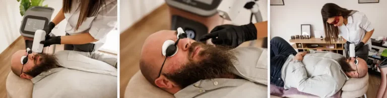 laserbehandling för hårväxt