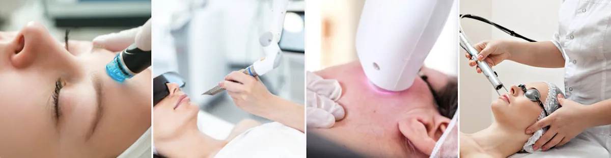 laserbehandling för hudfläckar