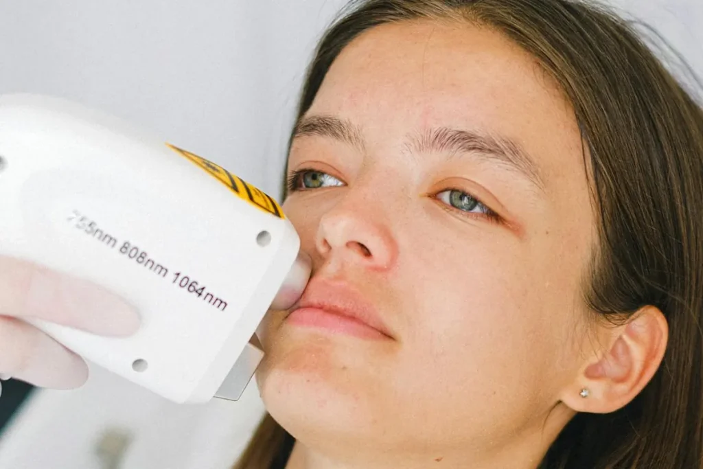 Laserbehandling för hudförbättring efter allergiska reaktioner