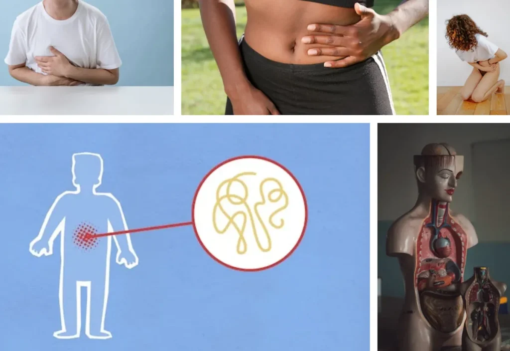 Laserbehandling för hudförbättring efter gastrointestinala sjukdomar