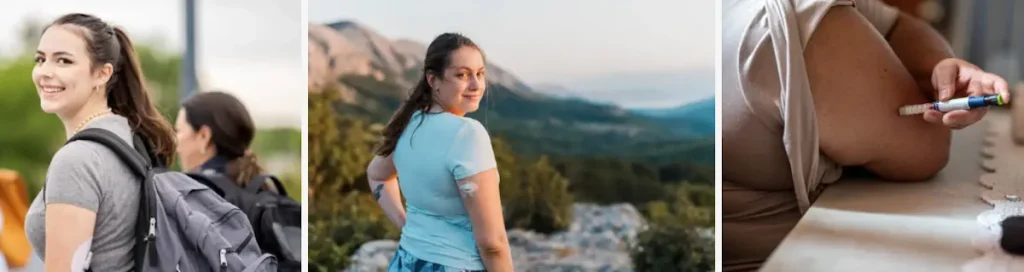 Laserbehandling för hudförbättring efter metaboliska sjukdomar