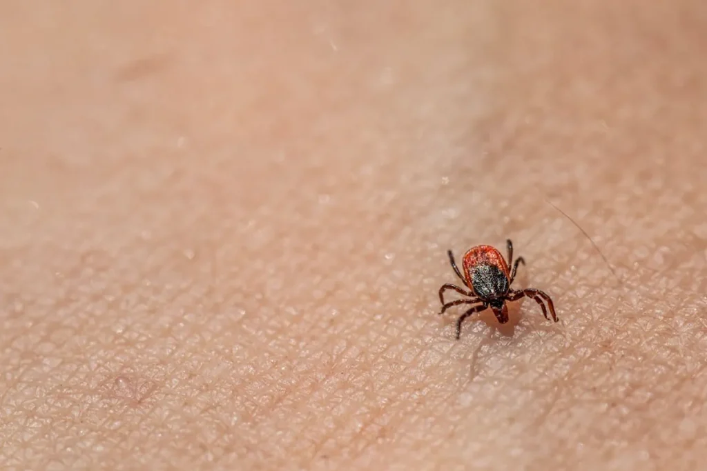 Laserbehandling för hudförbättring efter parasitinfektioner