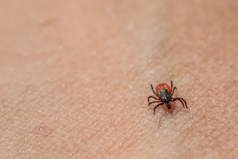 Laserbehandling för hudförbättring efter parasitinfektioner