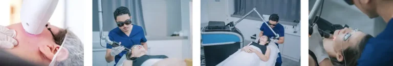laserbehandling för hudstramning