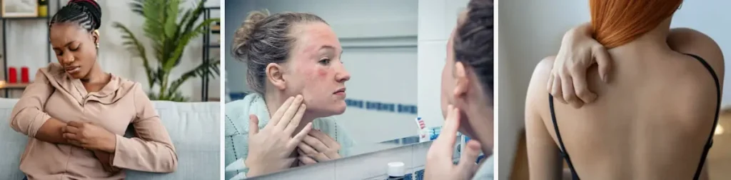 Laserbehandlingar för att förbättra hudens utseende efter kroniska sjukdomar