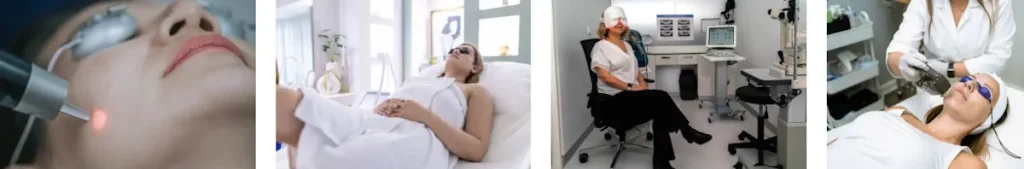 Laserbehandlingar för att förbättra hudens utseende efter psykologiska påfrestningar