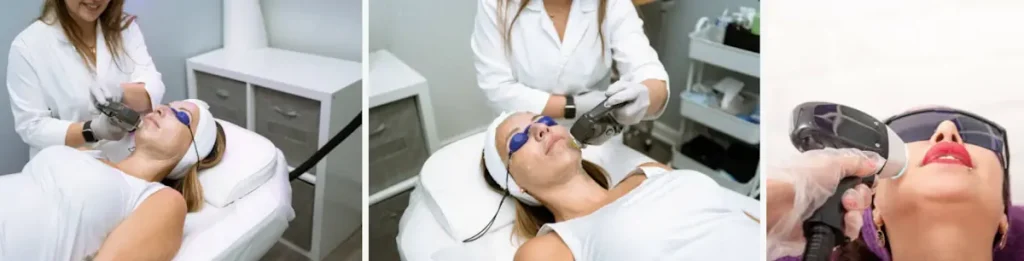 Laserbehandlingar för att reducera rodnad i ansiktet