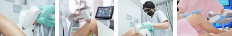 laserbehandlingar mot celluliter