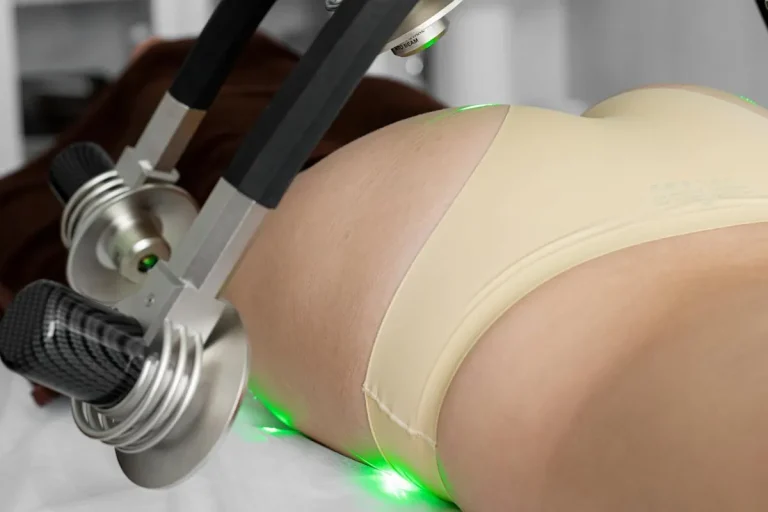 laserfettreduktion