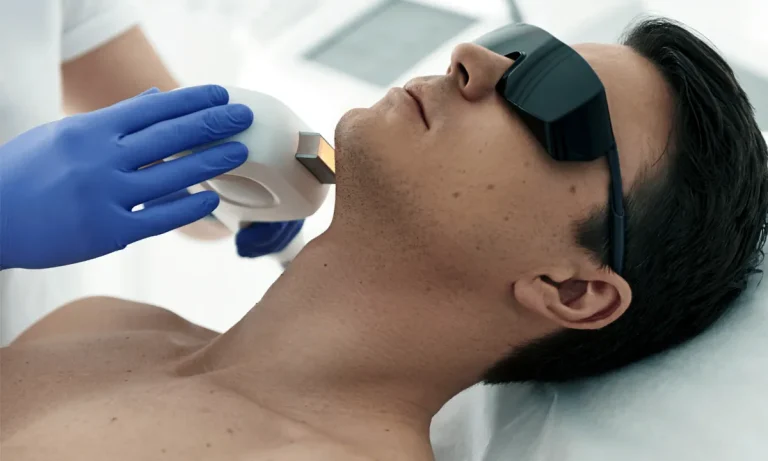 laserhårborttagning permanent