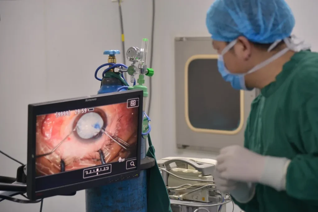 Laserkataraktoperation