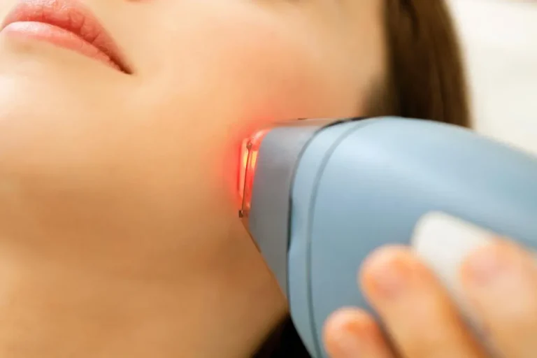 Laseroperation
