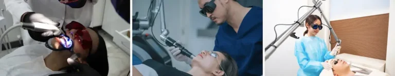 laseroperationer