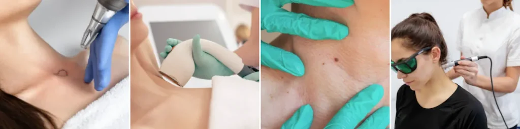 Laseroperationer för att förbättra halsens utseende