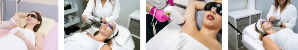 Laseroperationer för att förbättra hudens utseende efter antifungala behandlingar