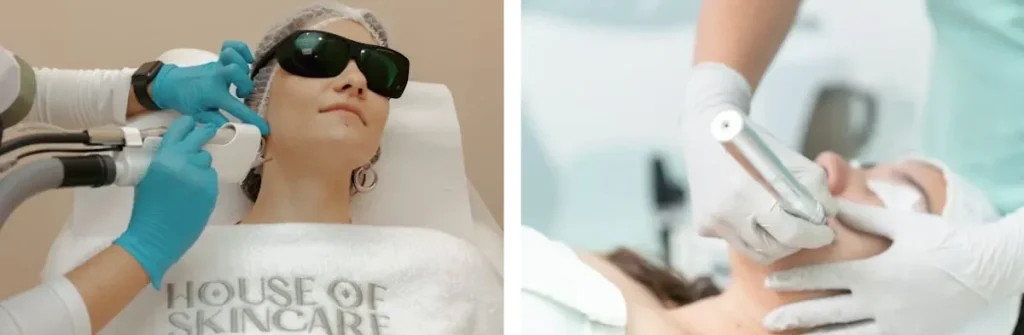 Laseroperationer för att förbättra hudton och textur