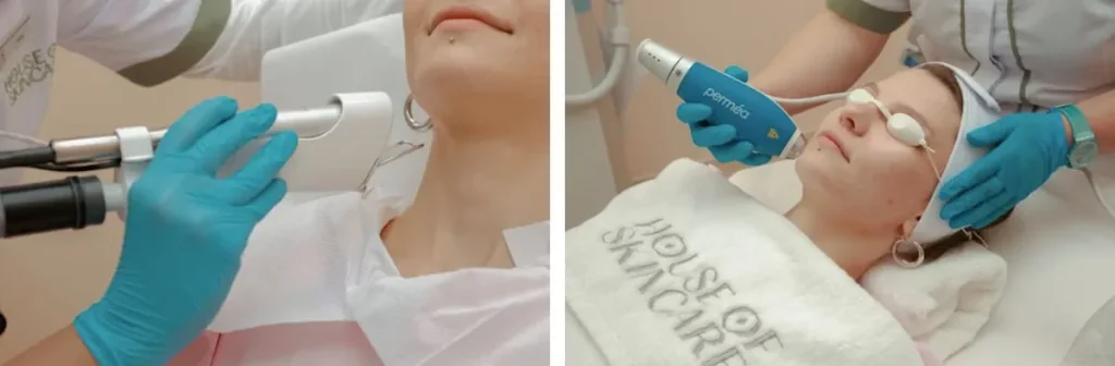 Laseroperationer för hudföryngring